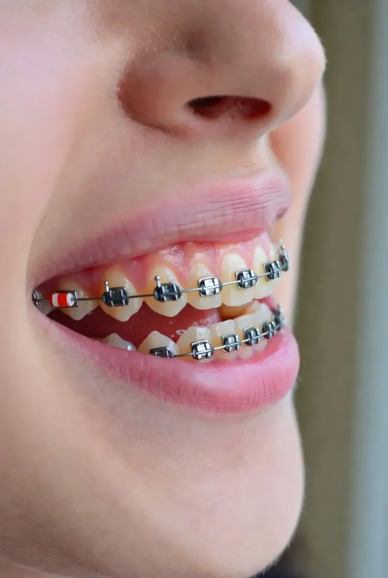 ارتودنسی دندان مشهد