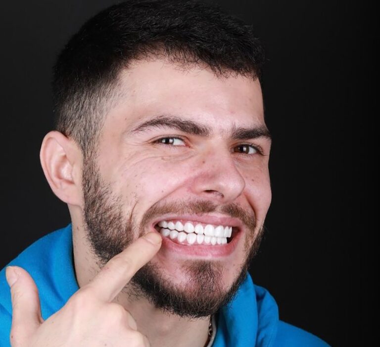 ایمپلنت دندان فک پایین در مشهد