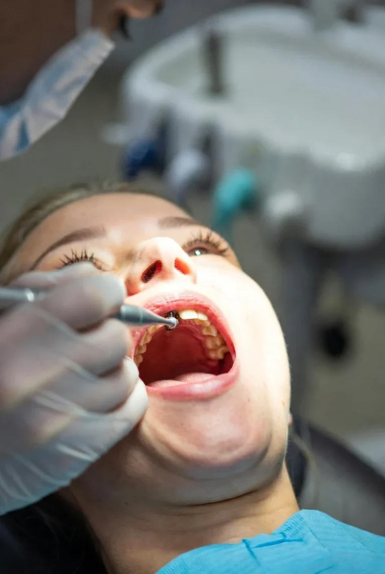 کاشت دندان جلو در مشهد