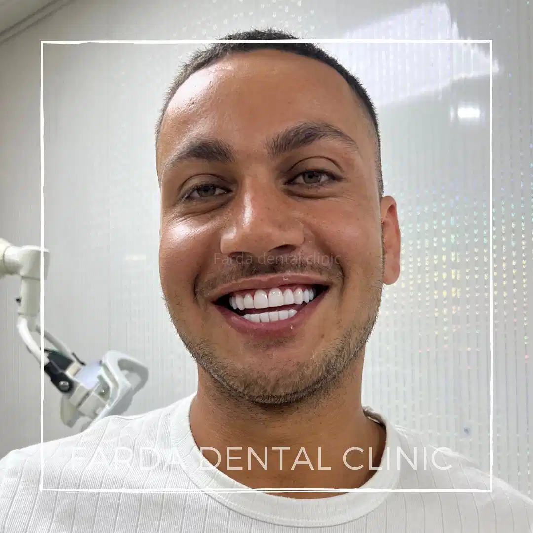 رضایت مشتری از کامپوزیت دندان مشهد